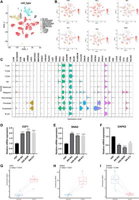 Identification of anoikis-related molecular patterns to define tumor microenvironment and predict immunotherapy response and prognosis in soft-tissue sarcoma